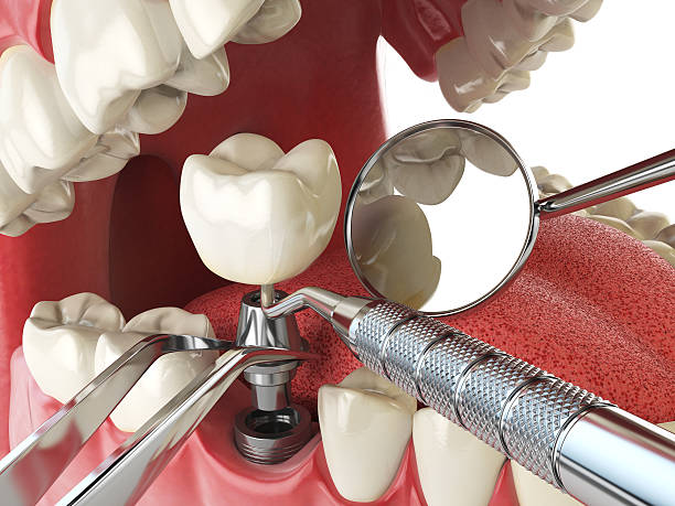 Best Emergency Broken Tooth Repair in Shawneeland, VA